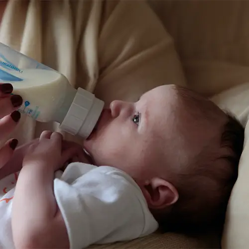Feeding bottle for baby with lip tie